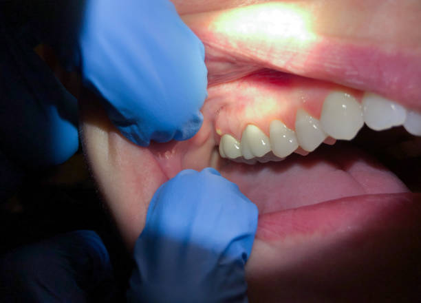 Best Emergency Denture Repair in Crowley Lake, CA